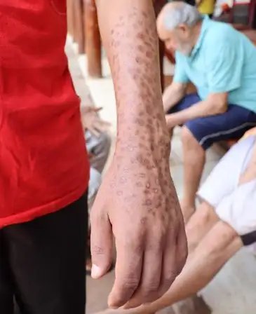 Brasília (DF), 27/03/2025 - Relatório elaborado pelo Mecanismo Nacional de Prevenção e Combate à Tortura (MNPCT), junto ao grupo Psicologia e Ladinidades da UnB, aponta violação sistemática de direitos em comunidades terapêuticas do país. Foto: MNPCT/Divulgação