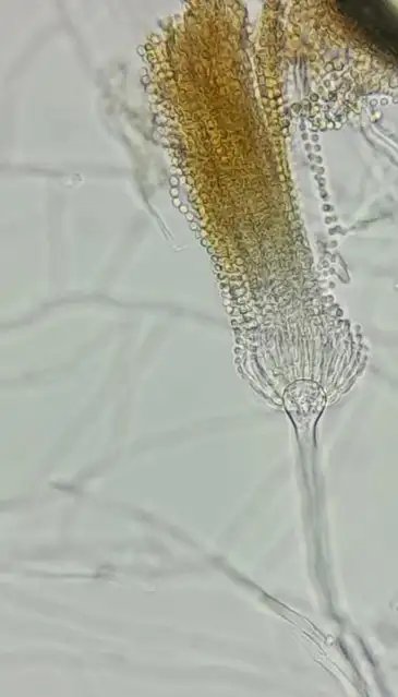 Mudanças climáticas já levam ao aumento de doenças infecciosas . Fungo do tipo Aspergilus . Foto: Sarah Tavares/ Arquivo Pessoal
